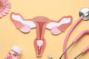 GLP-1 medications, PCOS, and female fertility care